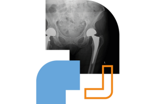 A x-ray of a hip set within curved angular corner shapes