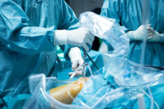 Lower Limb Fellowship
