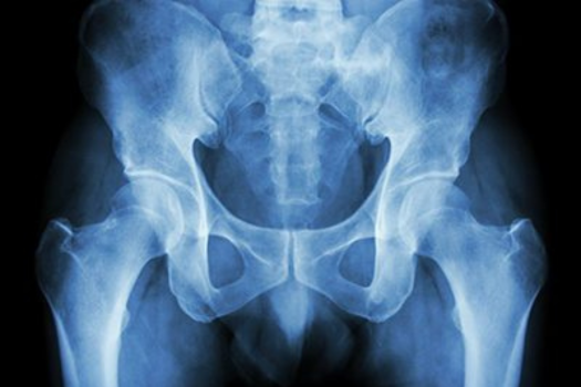 Pelvic and Acetabular Trauma Fellowship