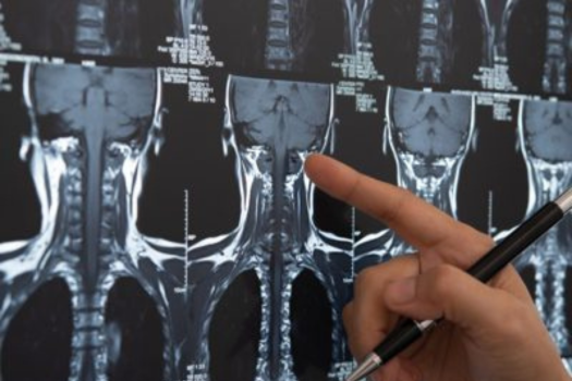 Spine Fellowship