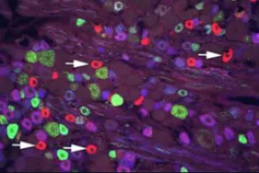 A unique population of TRPV1 expressing cells