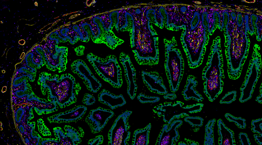 Spatial Biology Hub
