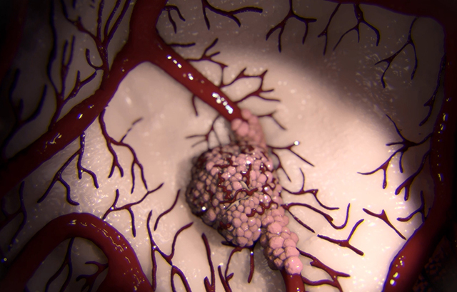 CREDIT: Barts Cancer Institute, QMUL