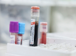 Vials containing blood. Credit: Centre for Trauma Sciences.