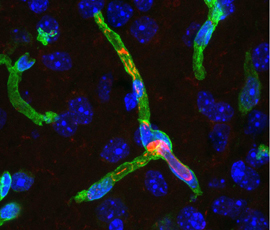 Cerebral capillary of an ANXA1 null mouse