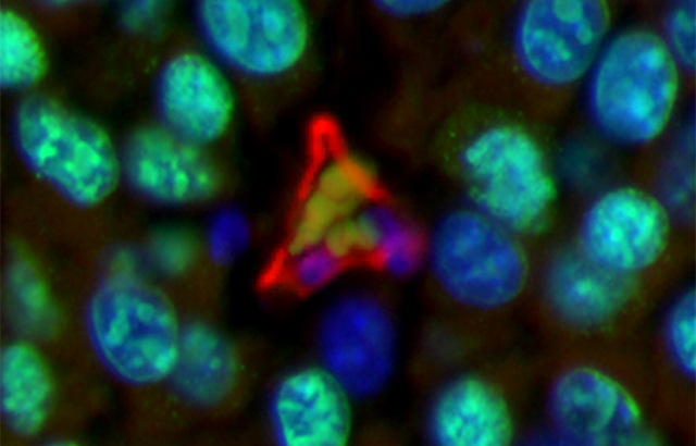 Tumour blood vessel endothelial cells (red), surrounded by tumour cell nuclei (blue and green). Red blood cells (green shapes) are visible in the centre of the blood vessel