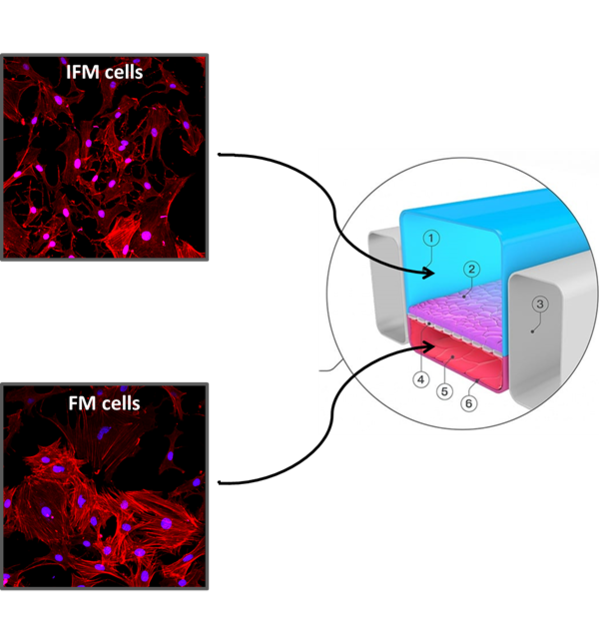 IFM cells