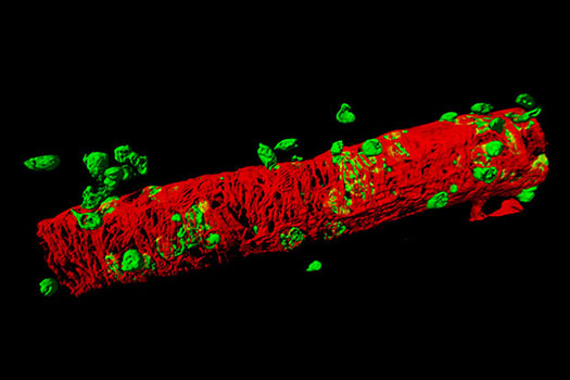 Neutrophil-pericyte-interactions-as-analysed-by-confocal-intravital-microscopy