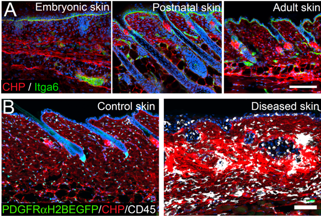 Figure 3: Investigating fibroblast collagen deposition and remodelling during skin development and disease. (A) Collagen fibres (red) start to appear in reticular dermis during embryonic development and collagen signal increases with age. (B) Fibrotic (diseased) skin is characterised by strong immune cell infiltration (CD45, white) and increased collagen deposition/remodelling.